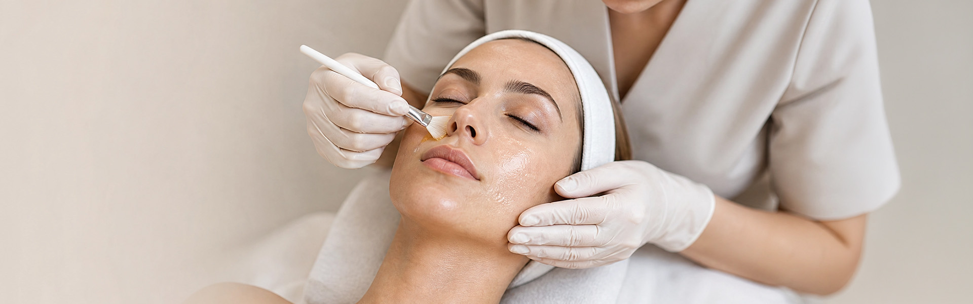 Chemical Peels