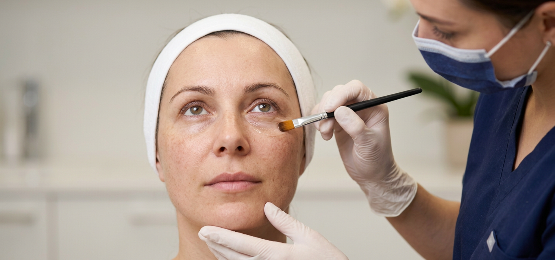 Under Eye Brightening Peel