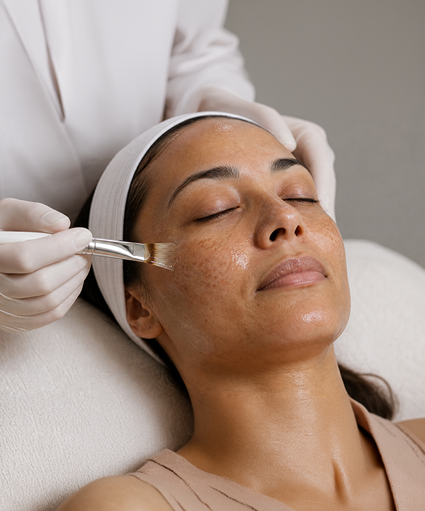 Pigmentation & Melasma Peel process