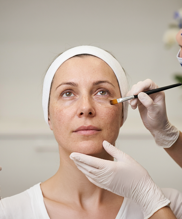 Under Eye Brightening Peel process
