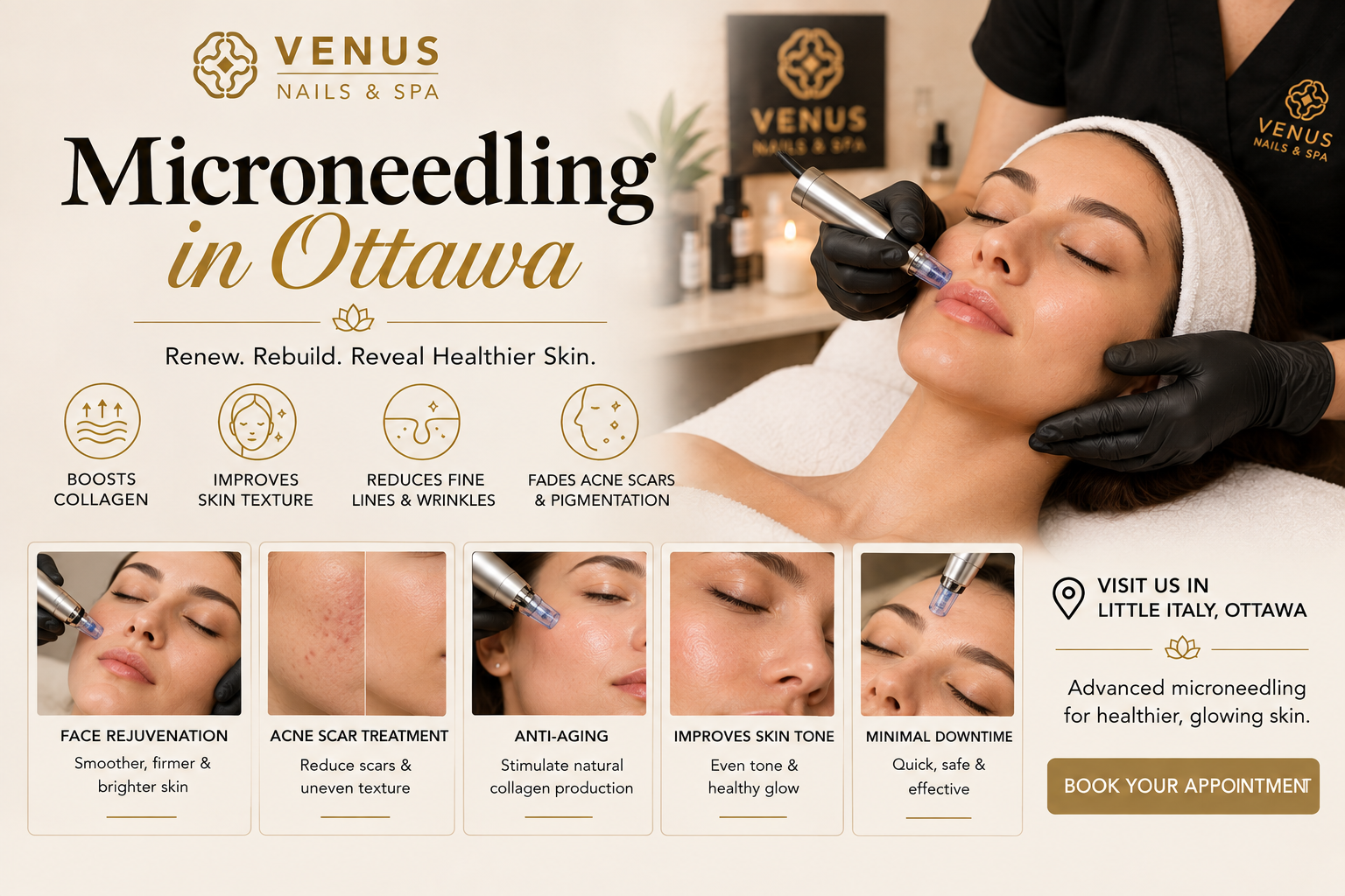 Microneedling Near Me in Ottawa: Complete Guide to Smoother, Firmer, More Even Skin